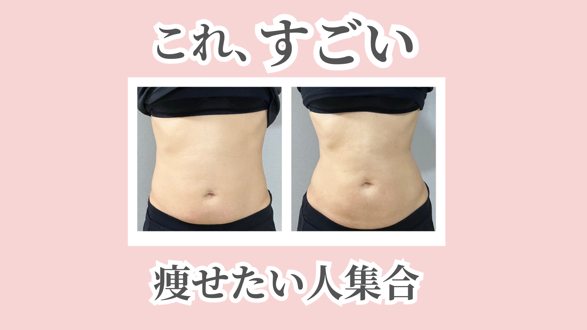 新導入!!キャビテーションのご紹介 | もみの樹整骨院